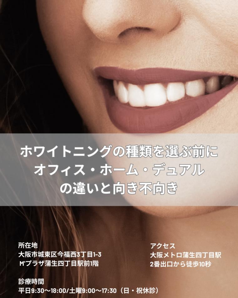 ホワイトニングの種類を選ぶ前に｜オフィス・ホーム・デュアルの違いと向き不向き