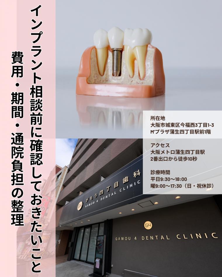 インプラント相談前に確認しておきたいこと｜費用・期間・通院負担の整理