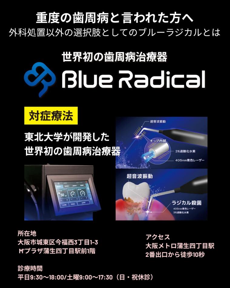 重度の歯周病と言われた方へ｜外科処置以外の選択肢としてのブルーラジカルとは