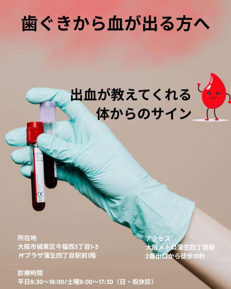 歯ぐきから血が出る方へ｜出血が教えてくれる体からのサイン